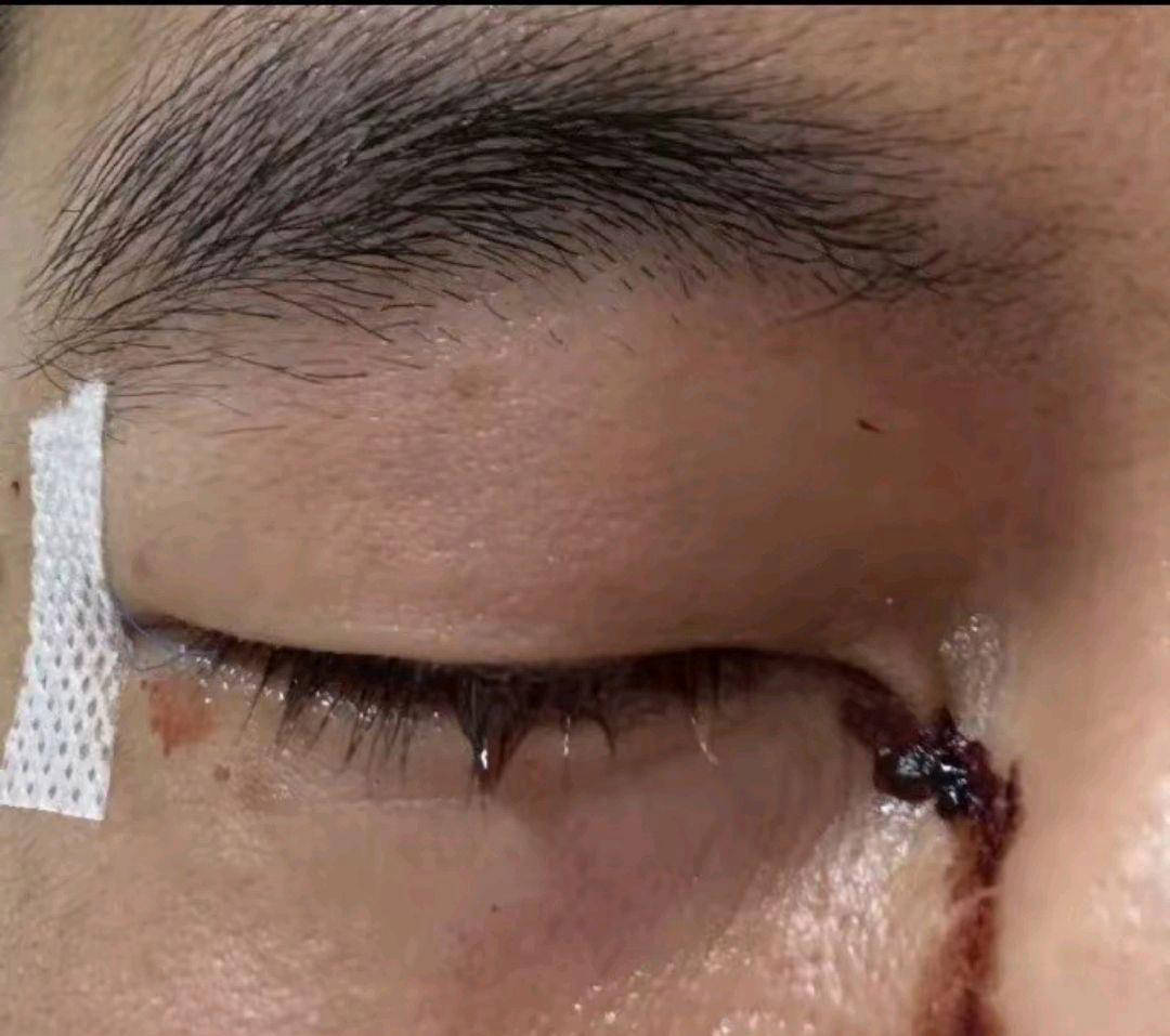 爱游戏官方入口-包含腓特烈王子球员伤停：竞技状态引人担忧的词条